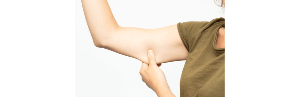 When should I consider an arm lift procedure?